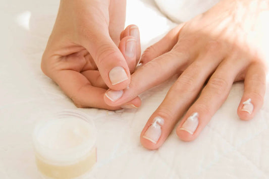 Gel Removal
